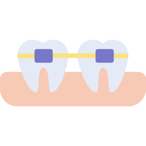 Orthodontic Braces and Aligners